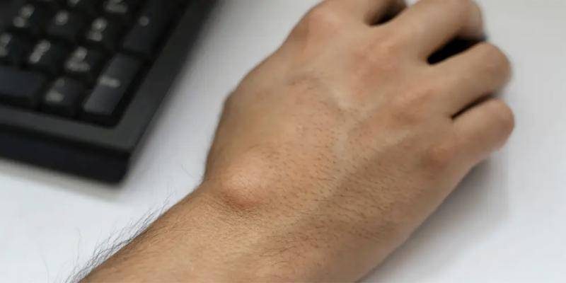 Cisto sinovial pode causar dor e desconforto